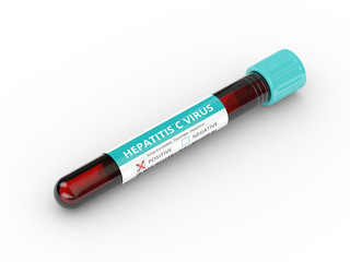3D rendering of test tube with  hepatitis C virus blood sample