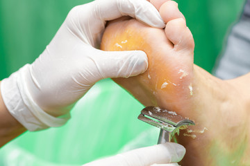 Pedicure  procedure in the beauty salon.  emover calluses on the