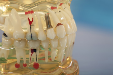 dental uygulamalar
