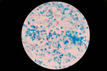Mycobacterium tuberculosis