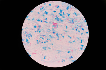 Mycobacterium tuberculosis