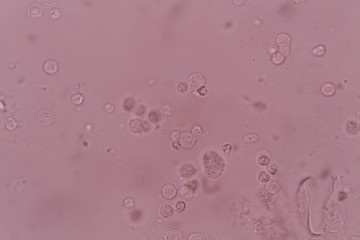 white blood cell  in urine