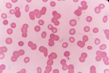 Blood smear show Rouleaux formation for complete blood count