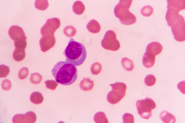 slide blood smear show plasme cell for complete blood count