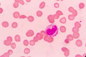 complete blood count