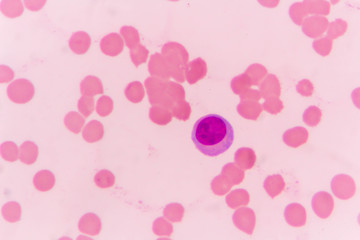 slide blood smear show plasma cell for complete blood count