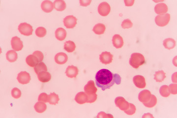 slide blood smear show plasma cell for complete blood count