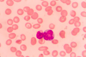 slide blood smear show monocyte for complete blood count
