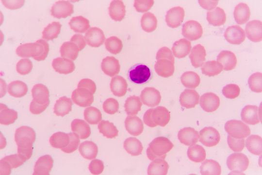 slide blood smear show lymphocyte for complete blood count