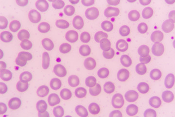 Red blood cell for complete blood count
