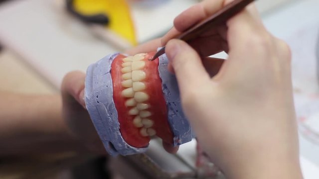 Female dental technician, manufacture process acrylic full denture.