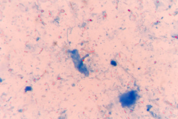 parasites microsporidia