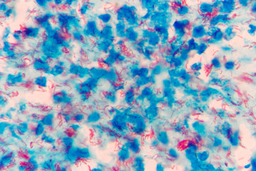 Mycobacterium tuberculosis undermicroscope