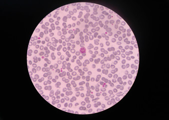 Malaria parasite P. vivax