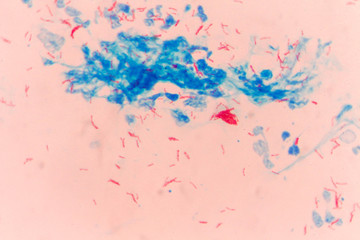 Mycobacterium tuberculosis undermicroscope