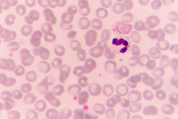 Malaria parasite P. vivax