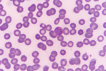 plasmodium malariae trophozoite (band form)
