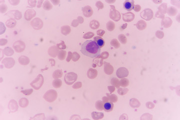 in slide blood smear show Nucleated red cell for complete blood count