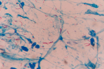 mycobacterium tuberculosis gram-negative  bacteria