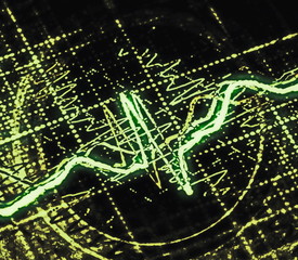 brain wave on electroencephalogram, EEG for epilepsy, illustration
