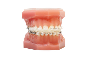 The image of a denture