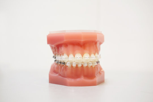 The image of a denture