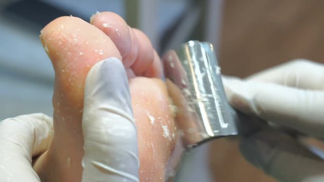 Pedicure procedure in the beauty salon. emover calluses on the feet.