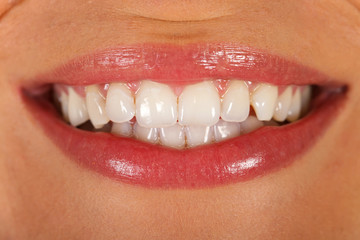 Perfect smile