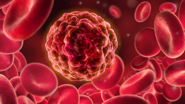 Krebszelle zwischen roten Blutkörperchen