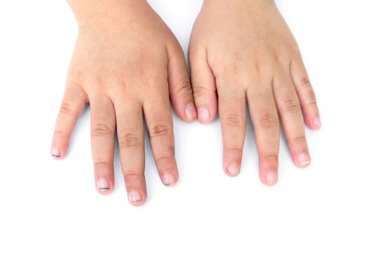 Children long nails isolated on white background.Children dirty