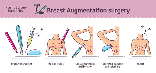 Vector Illustrated set with breast augmentation surgery © ant_art19