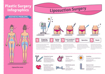Vector Illustrated set with liposuction surgery