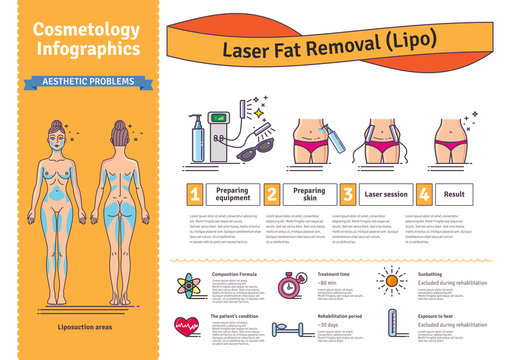 Vector Illustrated set with Laser LIPO Fat Removal