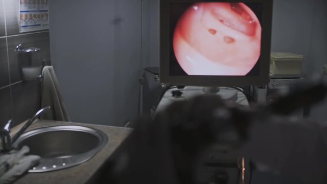 Doctor gastroenterologist with probe to perform gastroscopy and colonoscopy performs the procedure
