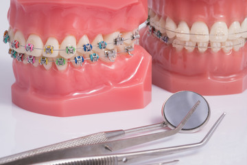 Dentist demonstration teeth model of varities of orthodontic bra