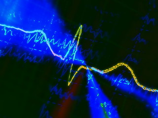 Ecg graph, electrocardiogram background