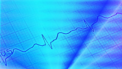 Naklejka premium Ecg graph, electrocardiogram background