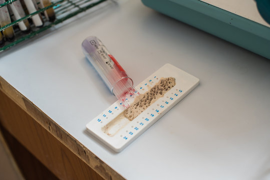 Hematocrit tube for laboratory