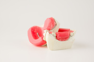 dental prosthesis manufacturing step