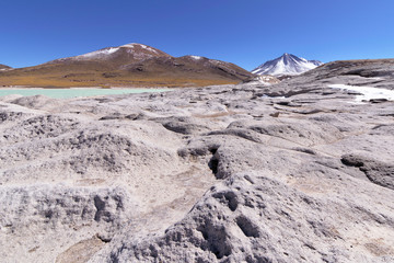 Stone formation