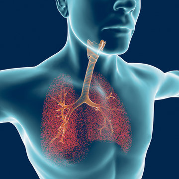 Bronchi, corpo umano, uomo, polmoni, infiammazione