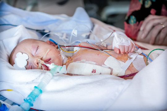 Child in intensive care unit after heart surgery. Shallow depth of field.