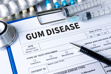 Obraz premium GUM DISEASE Medical concept Doctor Gum disease stages