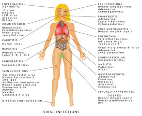 Viral infections. Viral infections - virus diseases. Viral infection chart. Viral infections and involved species. Infectious Diseases and Common Etiologic Bacteria
