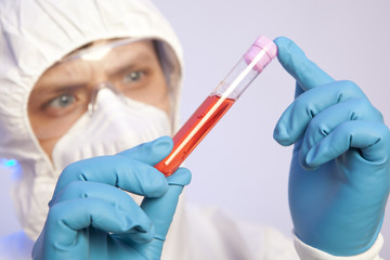 Scientist holds test tube with blood infected