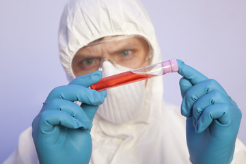 Scientist holds test tube with blood infected