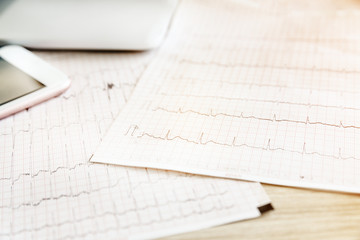 Electrocardiogram