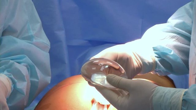 implants to increase the buttocks