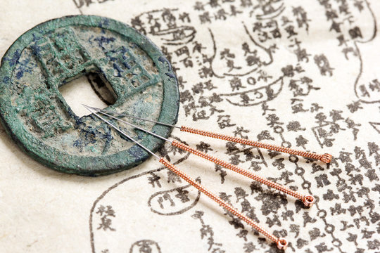 Acupuncture needles and ancient medicine book