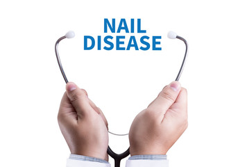  NAIL DISEASE Fungus Infection on Nails Hand, Finger with onycho